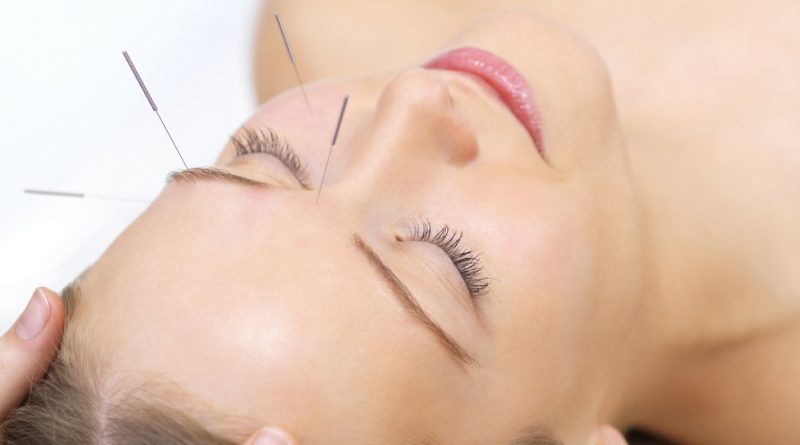 Wellness – Acupunctura